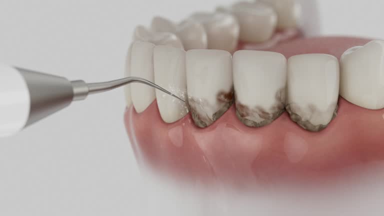 Trusted Invisalign Clear Aligners service in Leonard, TX - Dentist Open Now